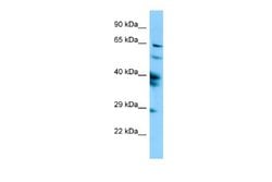 SPAG16 Rabbit anti-Human, Polyclonal, Novus Biologicals 0.1ml; Unconjugated:Antibodies,